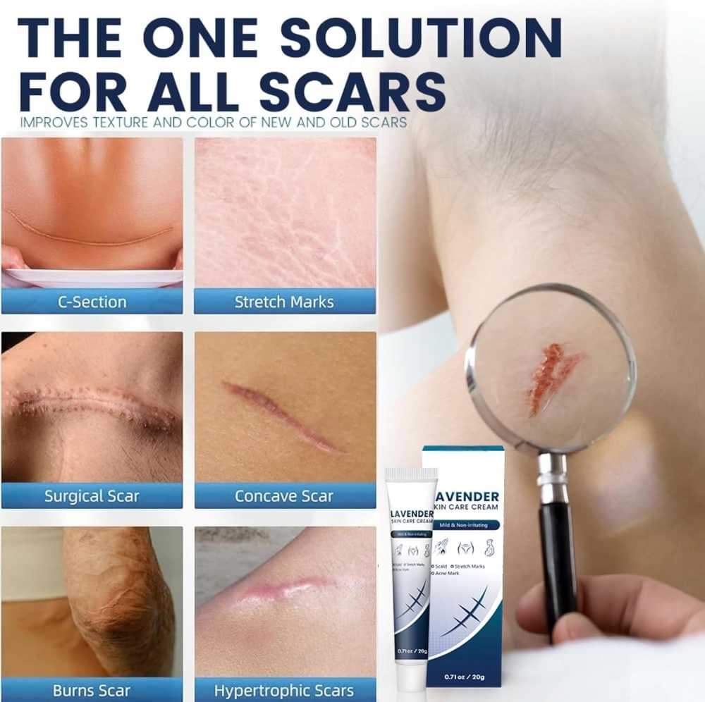 Lavender Skin Care Cream 20g - Scar Repair Cream for Burns, Stretch Marks, Acne Scars, and Old Scars, Soothing Lavender Infusion for Skin Recovery, Naturally Reduces the Appearance of Scars - Star Deal Treasure