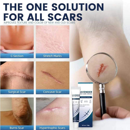 Lavender Skin Care Cream 20g - Scar Repair Cream for Burns, Stretch Marks, Acne Scars, and Old Scars, Soothing Lavender Infusion for Skin Recovery, Naturally Reduces the Appearance of Scars - Star Deal Treasure