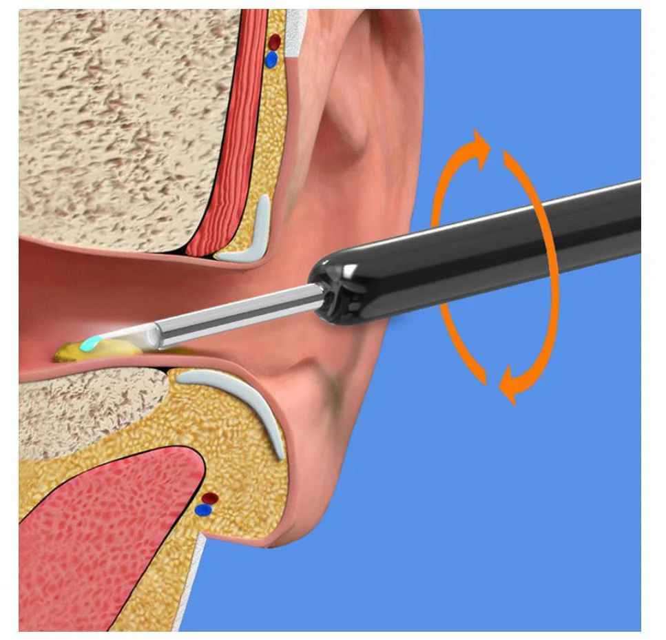 Smart Ear Wax Removal Kit with Wireless Ear Cleaning Camera
