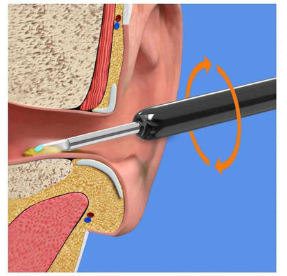 Smart Ear Wax Removal Kit with Wireless Ear Cleaning Camera