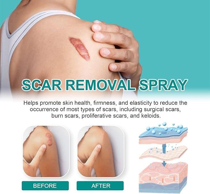Medical Scar Removal Spray - Star Deal Treasure