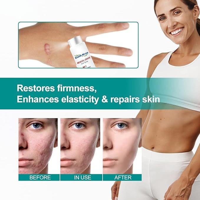 Medical Scar Removal Spray - Star Deal Treasure