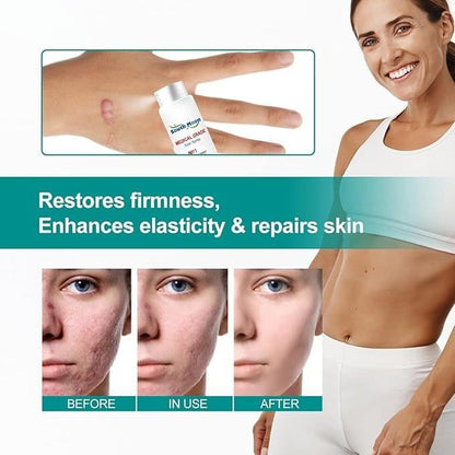 Medical Scar Removal Spray - Star Deal Treasure