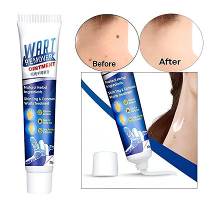 WartsOff Instant Blemish Removal Cream All Skin Types - Star Deal Treasure