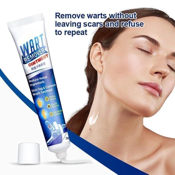 WartsOff Instant Blemish Removal Cream All Skin Types - Star Deal Treasure