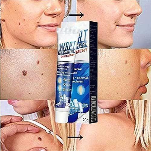 WartsOff Instant Blemish Removal Cream All Skin Types - Star Deal Treasure